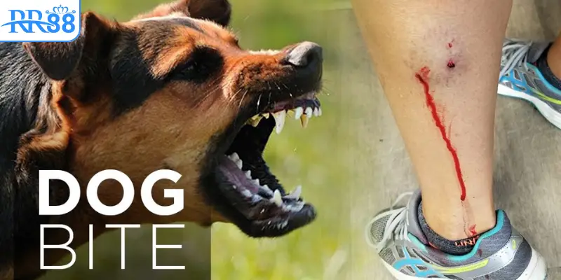 Mơ chó lạ cắn vào chân chảy máu